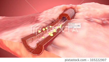 Artery dilates due to increase of ARBs in the blood 103222907
