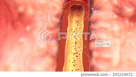 Artery dilates due to increase of ARBs in the blood 103224072