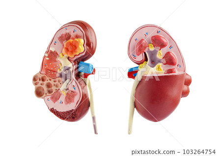Kidney model isolated on white background with clipping path. Chronic kidney disease, treatment urinary system, urology, Estimated glomerular filtration rate eGFR. 103264754