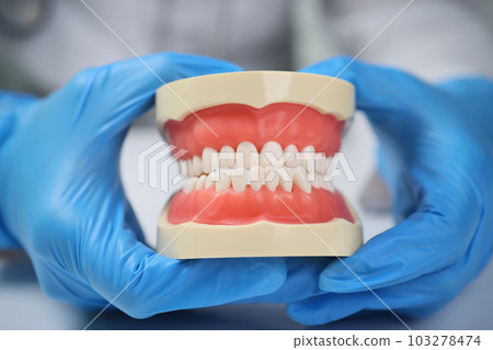 Hands of dentist in sterile gloves holding model of jaws Hands of dentist in sterile gloves holding model of jaws 103278474