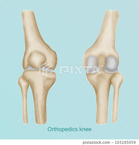 Orthopedics of knee anatomy ap and lateral view. Orthopedics of knee anatomy ap and lateral view. 103285059