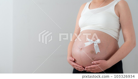 Pregnant female belly with a white bow and bruises as a concept of the joys and difficulties of childbirth 103326934