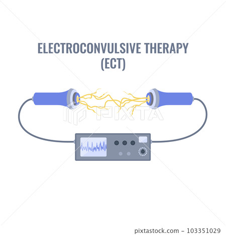 ECT electroconvulsive therapy for severe depression treatment 103351029