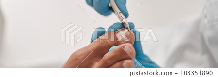 Professional podiatrist uses shny clipper to cut toenail of man in beauty salon 103351890