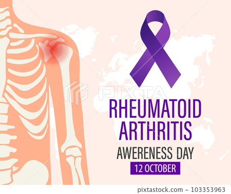 Rheumatoid Arthritis Awareness Day banner. Purple ribbon and male shoulder joint. Medical concept. Poster, banner Rheumatoid Arthritis Awareness Day banner. Purple ribbon and male shoulder joint. Medical concept. Poster, banner 103353963