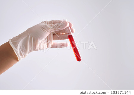 Test tube with blood in the hand. 103371144