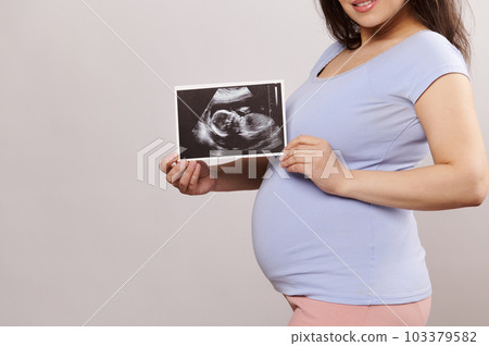 Close-up big belly of a smiling pregnant woman, expectant mother holding the ultrasound scan image of her future baby, over isolated studio background. Pregnancy. Childbirth. Expectation. Maternity 103379582