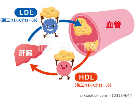 LDL和HDL血脂異常的機制 血管 膽固醇 103384644
