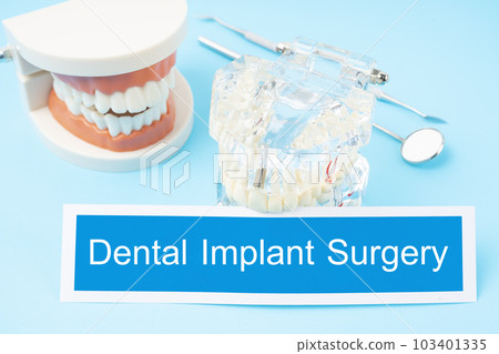 The Teeth model and dental tools on blue background, Dental implant surgery concepts The Teeth model and dental tools on blue background, Dental implant surgery concepts 103401335