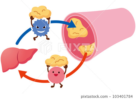 LDL和HDL血脂異常的機制 血管 膽固醇 LDL和HDL血脂異常的機制 血管 膽固醇 103401784