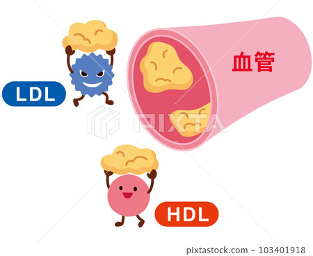 LDL和HDL血脂異常的機制 血管 膽固醇 103401918