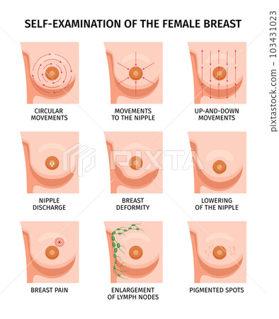 Breast Self Examination Set 103431023