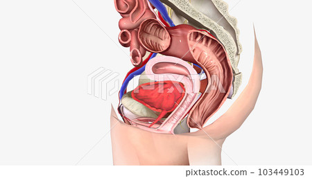 A cystocele is also known as a bladder prolapse, a fallen bladder, a prolapsed bladder, or an anterior vaginal prolapse. 103449103