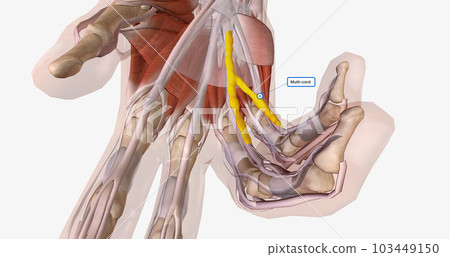 A Cystocele is Also Known As a Bladder Prolapse, a Fallen Bladder