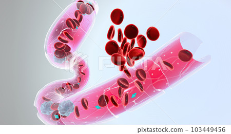 Hemophilia is a recessive genetic disorder that impairs the ability of blood to clot. Hemophilia is a recessive genetic disorder that impairs the ability of blood to clot. 103449456