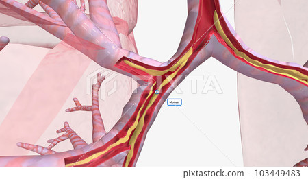 The Narrowed and inflamed airway 103449483