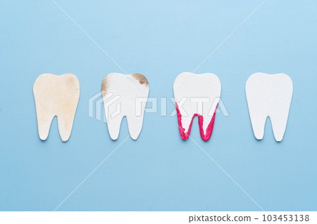 Dental problems cartoon made from paper. Set of teeth with different types Dental problems cartoon made from paper. Set of teeth with different types 103453138