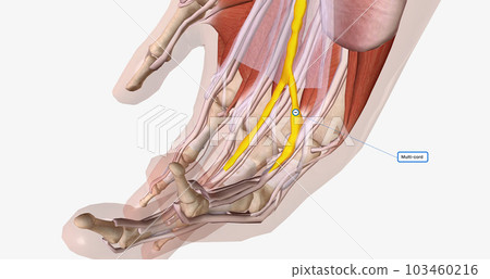 Fibrotic tissue and collagen may accumulate in the mottled, central, spiral, and lateral bands of the palmar aponeurosis or any finger. 103460216
