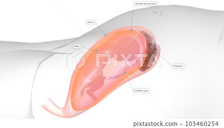 The Overview of Amniocentesis 3D The Overview of Amniocentesis 3D 103460254