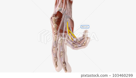 Fibrotic tissue and collagen may accumulate in... - Stock Illustration ...