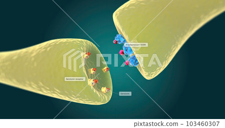 Selective serotonin reuptake inhibitors (SSRIs) are an antidepressant used to treat depression. Selective serotonin reuptake inhibitors (SSRIs) are an antidepressant used to treat depression. 103460307