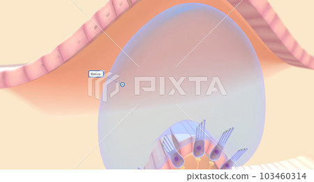 The semicircular canals have a dilated portion, or ampulla, that connects to the utricle. The semicircular canals have a dilated portion, or ampulla, that connects to the utricle. 103460314