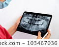 he x-ray is of an old young male female and explains the procedure 103467036