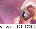 The dentist is holding dentures in his hands. 103467038