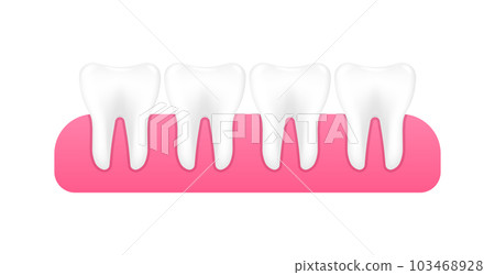 Dental model of teeth in the gum. Concept of dental examination of teeth. Dental health and hygiene. Realistic tooth model. Vector Illustration. 103468928