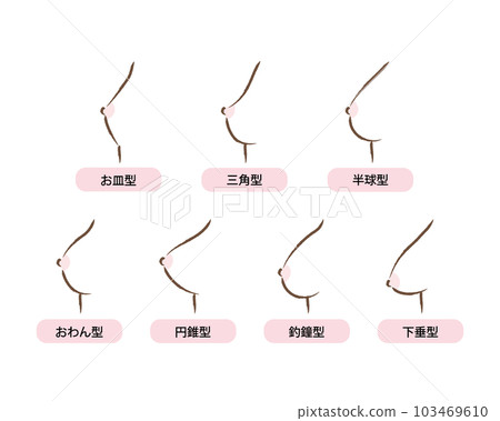 女性胸圍和乳房形狀類型的插圖 女性胸圍和乳房形狀類型的插圖 103469610