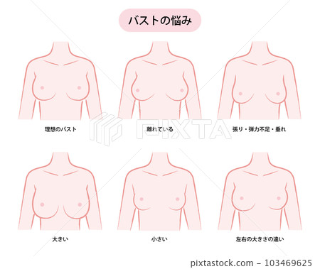 女性胸圍問題的插圖（尺寸/形狀） 103469625