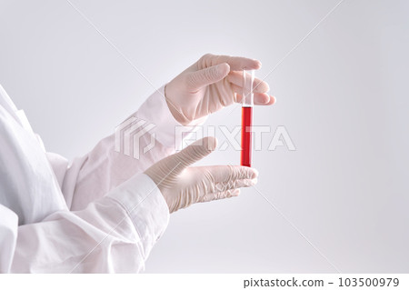 Test tube with blood in the hand. 103500979