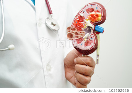 Chronic kidney disease, doctor holding model for treatment urinary system, urology, Estimated glomerular filtration rate eGFR. Chronic kidney disease, doctor holding model for treatment urinary system, urology, Estimated glomerular filtration rate eGFR. 103502926