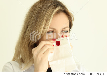 Young woman wipes nose with napkin stopping bleeding 103509311