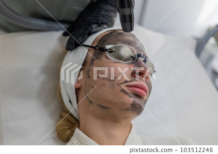 Proficient beautician provides a skin exfoliation treatment using carbon fiber. Proficient beautician provides a skin exfoliation treatment using carbon fiber. 103512248