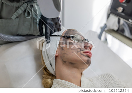 Beautician performs a carbon fiber based skin exfoliation treatment. Beautician performs a carbon fiber based skin exfoliation treatment. 103512254