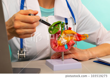 Doctor gynecologist showing pen on plastic model human pancreas closeup 103519273