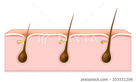 Hair growth. Cross section of a human skin with Hair follicles. Hair growth. Cross section of a human skin with Hair follicles. 103551206