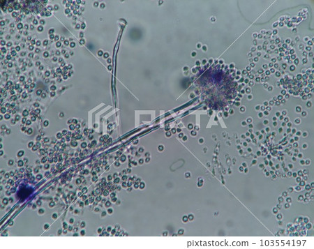 在冰箱中發現的黴菌顯微照片 在冰箱中發現的黴菌顯微照片 103554197