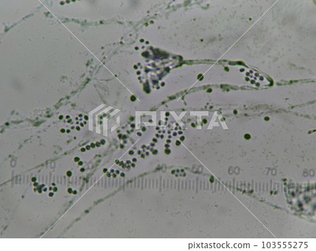 Mold present in the sewage system Mold present in the sewage system 103555275