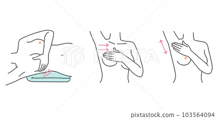 Breast cancer self-examination self-check Breast cancer self-examination self-check 103564094