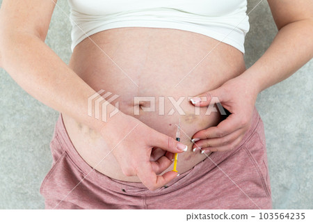 Blood thinners concept. Pregnant woman making injection in stomach 103564235