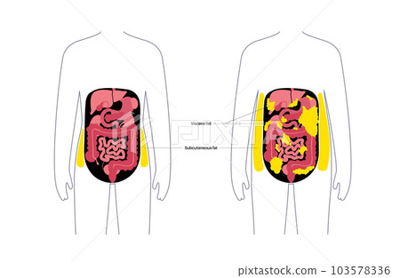 Visceral fat diagram 103578336