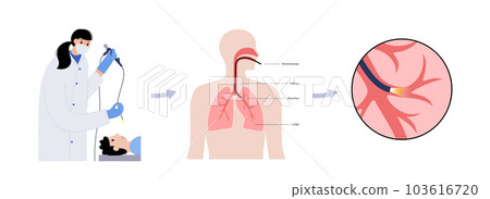 Bronchoscopy procedure concept 103616720