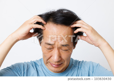 稀疏的頭髮圖像 稀疏的頭髮圖像 103630430