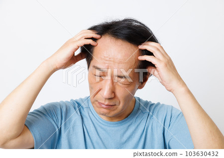 稀疏的頭髮圖像 稀疏的頭髮圖像 103630432