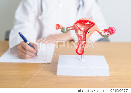 Doctor with Uterus and Ovaries anatomy model. Ovarian and Cervical cancer, Cervix disorder, Endometriosis, Hysterectomy, Uterine fibroids, Reproductive system, Pregnancy and health concept Doctor with Uterus and Ovaries anatomy model. Ovarian and Cervical cancer, Cervix disorder, Endometriosis, Hysterectomy, Uterine fibroids, Reproductive system, Pregnancy and health concept 103639677
