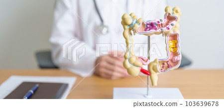 Doctor with human Colon anatomy model. Colonic disease, Large Intestine, Colorectal cancer, Ulcerative colitis, Diverticulitis, Irritable bowel syndrome, Digestive system and Health concept Doctor with human Colon anatomy model. Colonic disease, Large Intestine, Colorectal cancer, Ulcerative colitis, Diverticulitis, Irritable bowel syndrome, Digestive system and Health concept 103639678