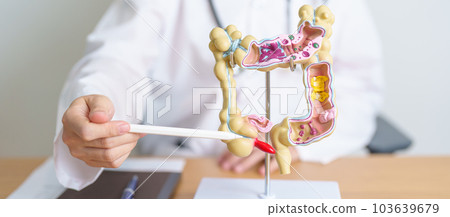 Doctor with human Colon anatomy model. Colonic disease, Large Intestine, Colorectal cancer, Ulcerative colitis, Diverticulitis, Irritable bowel syndrome, Digestive system and Health concept Doctor with human Colon anatomy model. Colonic disease, Large Intestine, Colorectal cancer, Ulcerative colitis, Diverticulitis, Irritable bowel syndrome, Digestive system and Health concept 103639679