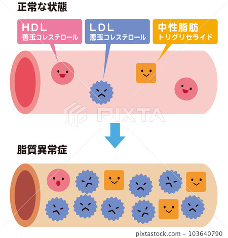 正常血管與血脂異常血管 膽固醇 103640790